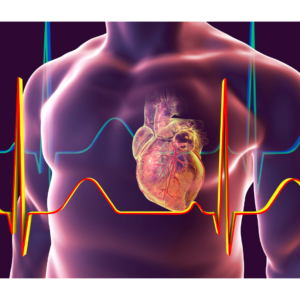 Wat is een hartfilmpje (ECG) MediHealthGroup