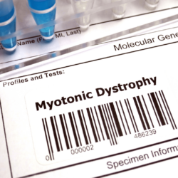 Myotone Dystrofie Type 1 De verbinding met hartgezondheid MediHealthGroup MHG